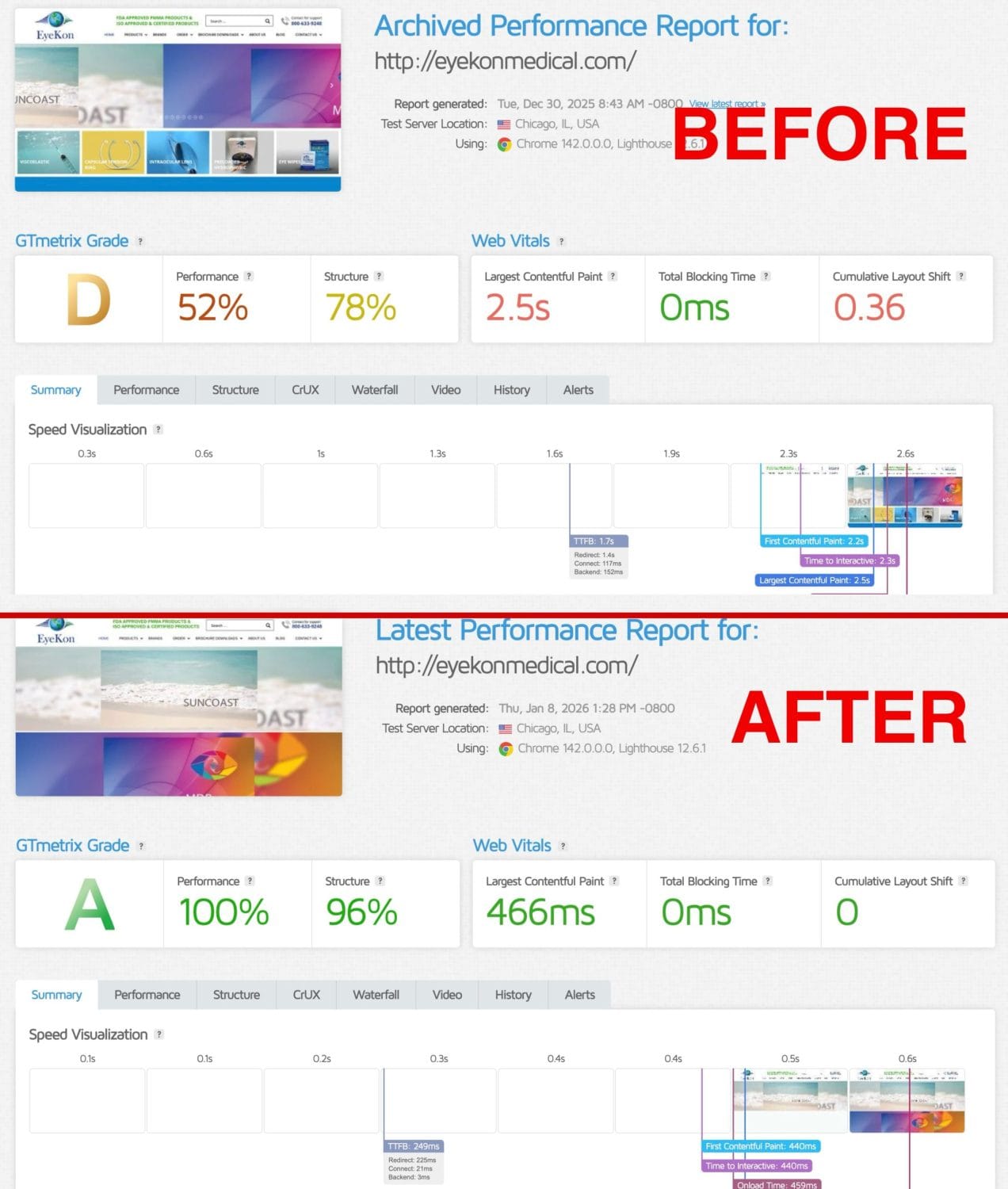 Before and After HyperPress EyeKon – local